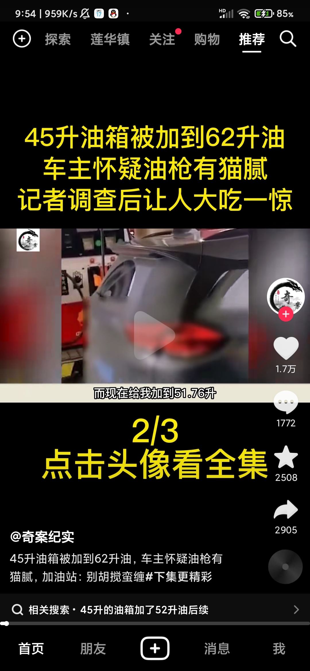 抖音頭像上快進(jìn)按鈕怎么設(shè)置？