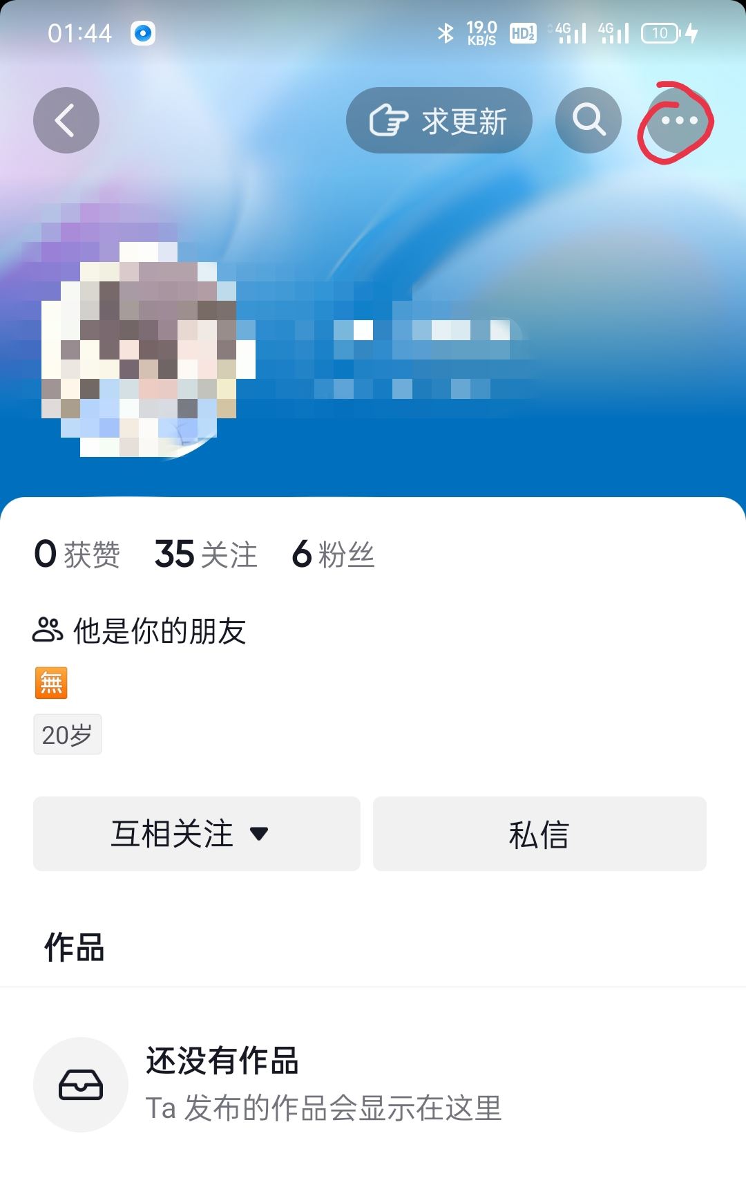 怎么移除抖音上面的朋友，對(duì)方會(huì)知道嗎？