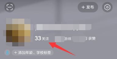 頭條如何添加抖音好友？